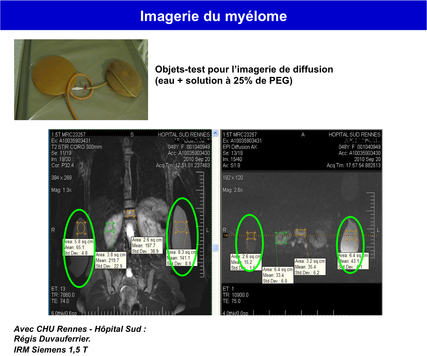 clinique-myelome.png